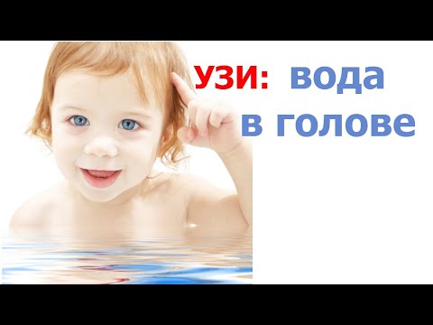 Видео: Вода (жидкость) в голове. Как расшифровать УЗИ  и  что делать