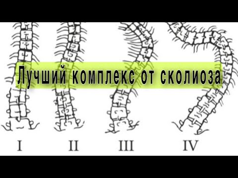 Видео: Полный комплекс при сколиозе любой степени.