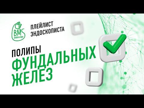 Видео: 🟢Полипы фундальных желез #playlistэндоскописта/ #эндоскопия #гастроскопия #эгдс