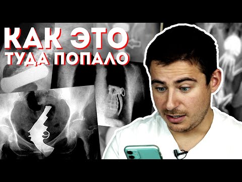 Видео: Как это туда попало? | Разбираю рентгеновские снимки с инородными телами и угадываю объекты