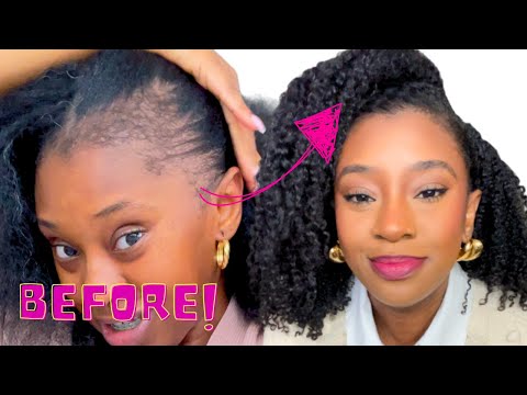 Видео: УСТРАНИТЕ ПОСЛЕРОДОВУЮ ВЫПАДЕНИЕ ВОЛОС ЗА 3 ПРОСТЫХ ШАГА | Моя история