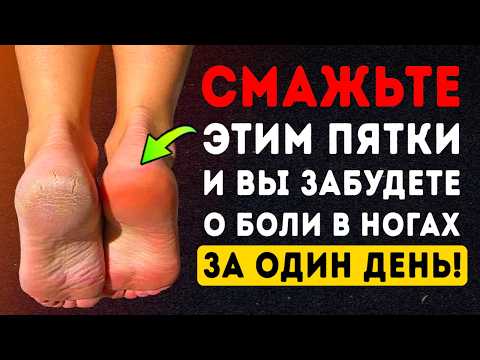 Видео: Смажьте этим и Пятки как у Младенца всего за одну ночь! Секрет, о котором молчат врачи