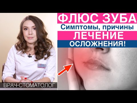 Видео: Флюс зуба, лечение флюса зуба, обострение периодонтита - симптомы, причины, осложнения флюса!