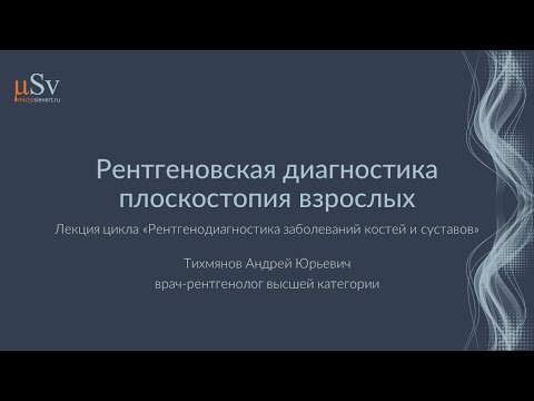 Видео: Рентгеновская диагностика плоскостопия взрослых