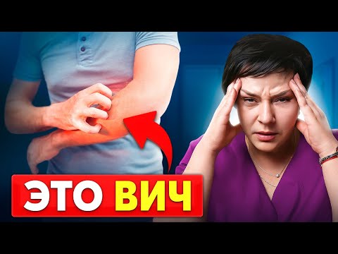 Видео: ВИЧ: 8 первых симптомов, которые нельзя игнорировать!