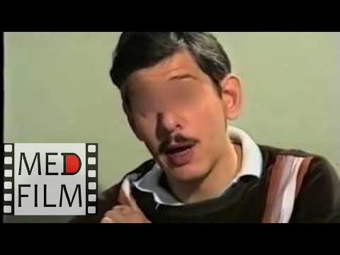 Видео: Слабоумие. Трудоустройство. Математика. Менингоэнцефалит в детстве © dementia, meningoencephalitis