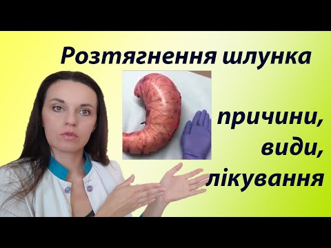 Видео: Розтягнутий шлунок що це? Збільшений і опущений шлунок, чи є різниця  Як зменшити розширений шлунок?