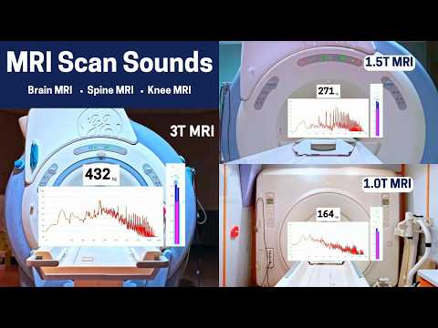 Видео: Звуки при сканировании МРТ 1 Тесла, 1,5 Тл и 3 Тл (с частотным анализатором)