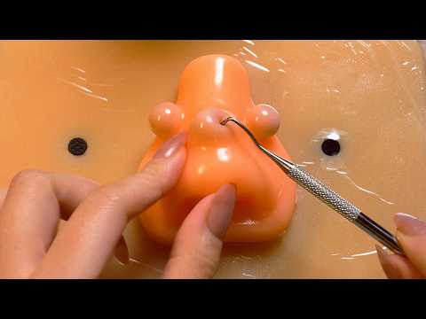Видео: [ASMR] Лечение манекена с акне👩‍⚕️ ACMP