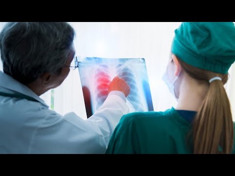 Видео: Простые вопросы Профилактика рака лёгких 25 1060