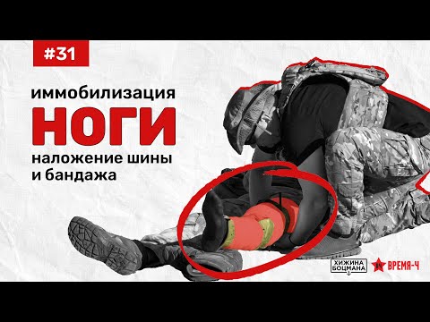 Видео: Как иммобилизировать НОГУ с помощью шины и бандажа (ТЕМА №31)