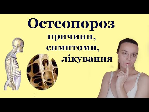 Видео: Остеопороз симптоми, причини, діагностика, лікування в домашніх умовах. Лічниця сестер Похмурських.