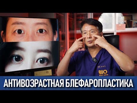 Видео: Антивозрастная хирургия глаз: как работает один из лучших хирургов Кореи