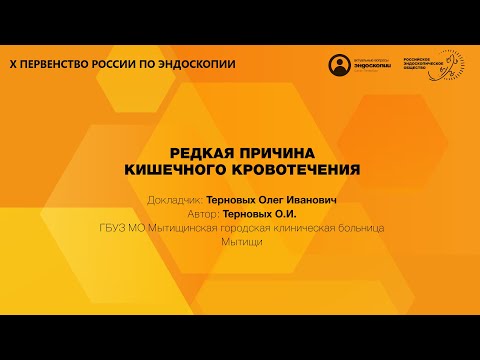 Видео: РЕДКАЯ ПРИЧИНА КИШЕЧНОГО КРОВОТЕЧЕНИЯ