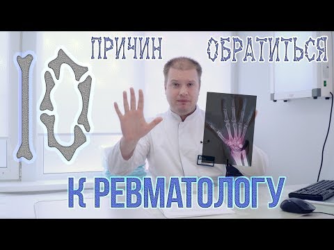 Видео: ТОП-10 Причин обратиться к ревматологу!