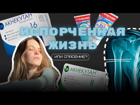 Видео: МОЙ ПУТЬ ЛЕЧЕНИЯ АКНЕ. Акнекутан и его  СТРАШНЫЕ ПОБОЧКИ