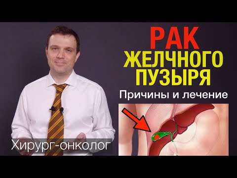 Видео: Рак желчного пузыря - причины, факторы риска, лечение. Опухоль желчного пузыря.