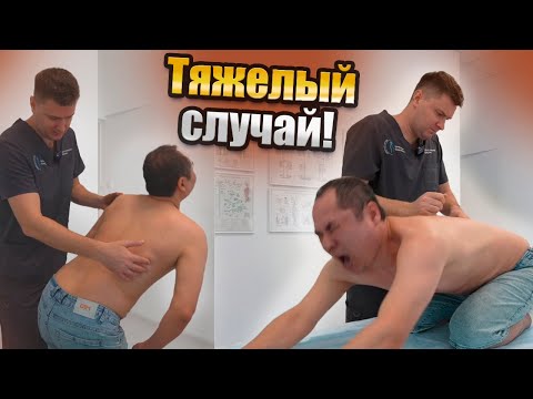 Видео: НЕ для СЛАБОНЕРВНЫХ! ЗАКЛИНИЛО так, что не может СТОЯТЬ. Спасаем спину от адских болей | г.Москва
