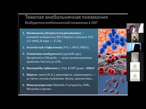 Видео: Внебольничная пневмония, особенности течения по этиологии