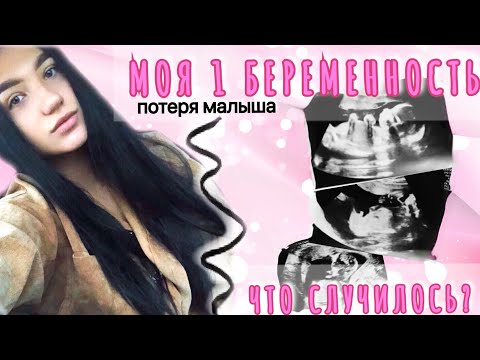 Видео: МОЯ ПЕРВАЯ БЕРЕМЕННОСТЬ. РОДЫ. ЧТО СЛУЧИЛОСЬ?