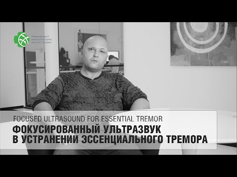 Видео: Устранение тремора на обе руки. Отзыв пациента (Эссенциальный тремор, МРФУЗ)