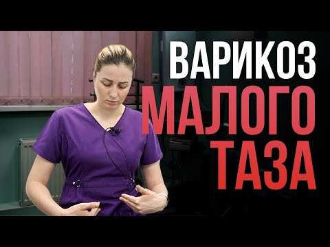 Видео: Варикоз малого таза у женщин. Как лечится?