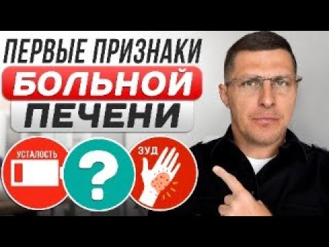 Видео: ПЕРВЫЕ СИМПТОМЫ ПРОБЛЕМ С ПЕЧЕНЬЮ. КАК ПОНЯТЬ ЧТО У ТЕБЯ ЦИРРОЗ, ФИБРОЗ, ГЕПАТОЗ