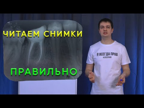 Видео: Снимки зубов - как читать правильно