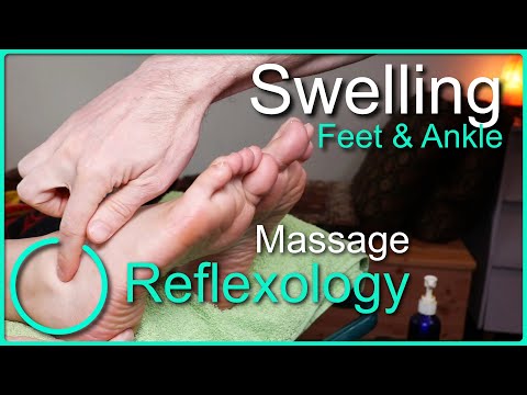 Видео: Методы рефлексотерапии и массажа для лечения отёков лодыжек и стоп