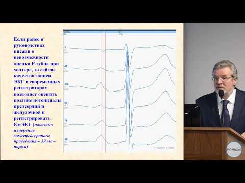 Видео: Современные возможности холтеровского мониторирования