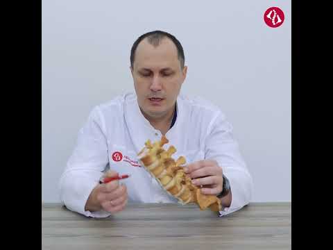 Видео: Спондилолистез. Всё о смещении позвонков