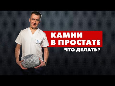 Видео: Камни в простате. Что делать?