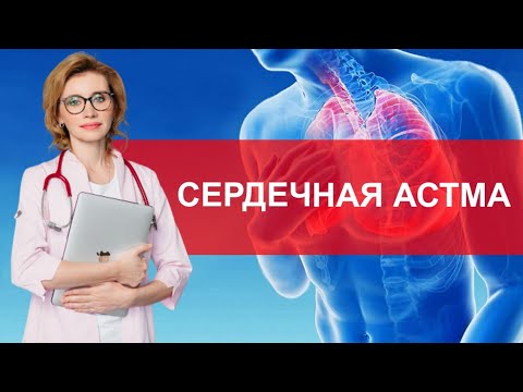 Видео: Сердечная астма. Что важно знать?