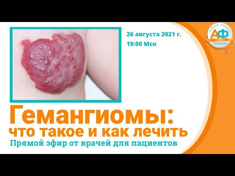 Видео: Гемангиомы: что это такое и как лечить?