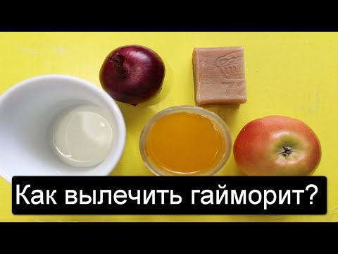 Видео: Как ВЫЛЕЧИТЬ гайморит без антибиотиков НАВСЕГДА?
