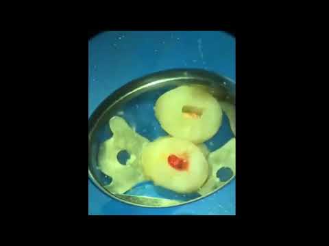 Видео: 2021-01-14 Пульпит, сделал ступеньку