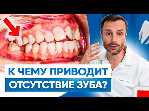 Видео: Что будет с вашей внешностью, если у вас нет зуба. Экспертное мнение ортодонта