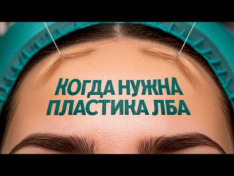 Видео: Пластика лба. Когда можно и нужно сделать себе красивый лоб?