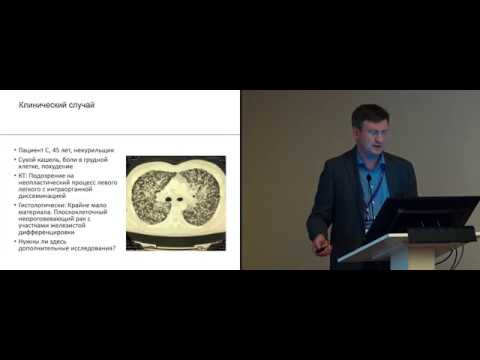 Видео: Таргетная терапия НМРЛ. Неадекватный объем ткани для молекулярного тестирования. Что делать?