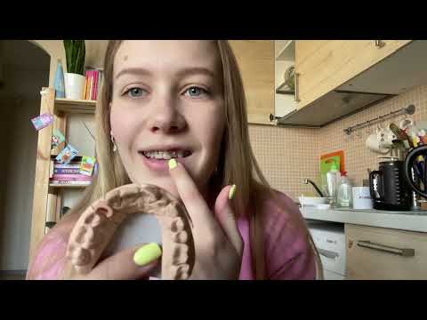 Видео: 5 НЕДЕЛЬ С БРЕКЕТАМИ #историябрекетов #мояистория #брекеты #5недель