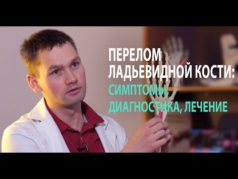 Видео: Перелом ладьевидной кости: симптомы, диагностика, лечение