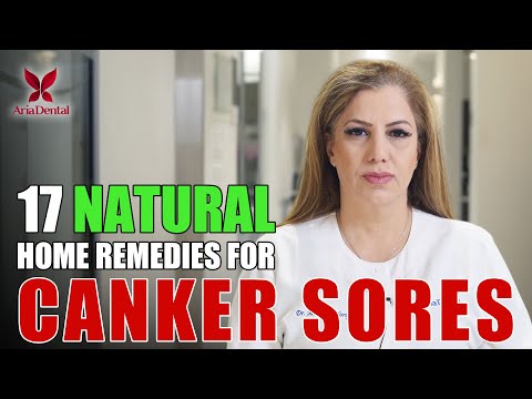 Видео: 17 натуральных домашних средств от стоматита | Aria Dental | Maryam Horiyat DDS.