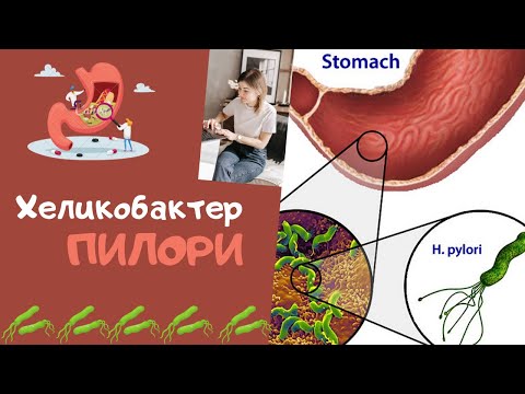 Видео: Хеликобактер Пилори 🦠 Как избавиться без антибиотиков?