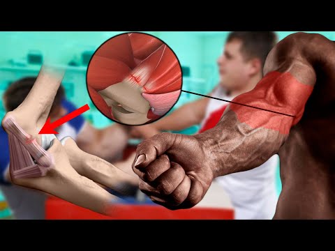 Видео: ТРАВМЫ В АРМРЕСТЛИНГЕ | ЛАТЕРАЛЬНЫЙ ЭПИКОНДИЛИТ | ТЕОРИЯ АРМРЕСТЛИНГА | КАРАНТИН