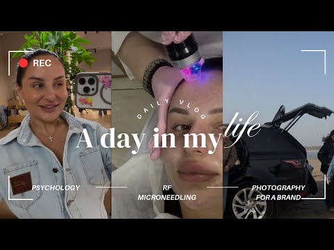 Видео: VLOG: микроигольчатый RF / съемки для бренда / психология как принять себя с недостатками