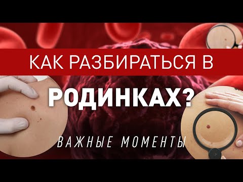 Видео: Родинки или Меланома, как разобраться самостоятельно?