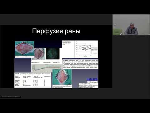 Видео: Лапаротомия часть 2 Егиев В.Н.