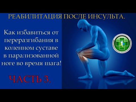 Видео: Восстановление после инсульта. Избавляемся от переразгибания колена при шаге. Часть 3.