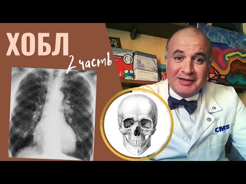 Видео: Хроническая обструктивная болезнь легких - 2. Диагностика, прогноз и лечение ХОБЛ