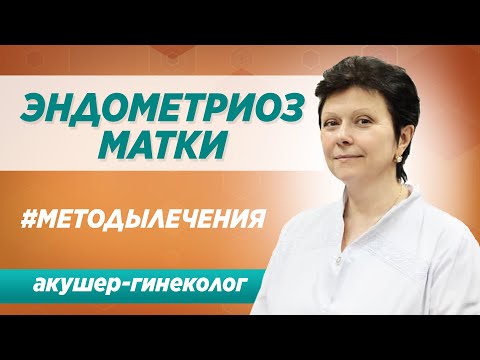 Видео: Лечение эндометриоза матки. Симптомы, диагностика, а также  методы лечения эндометриоза.